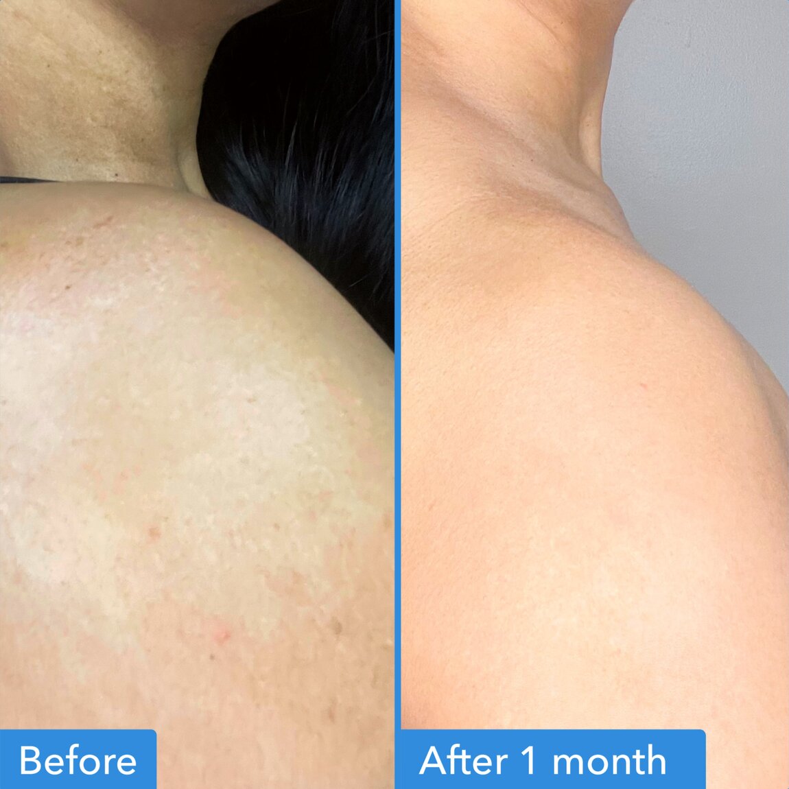 discoloration-correcting-body-treatment-i3 zb_p.jpg