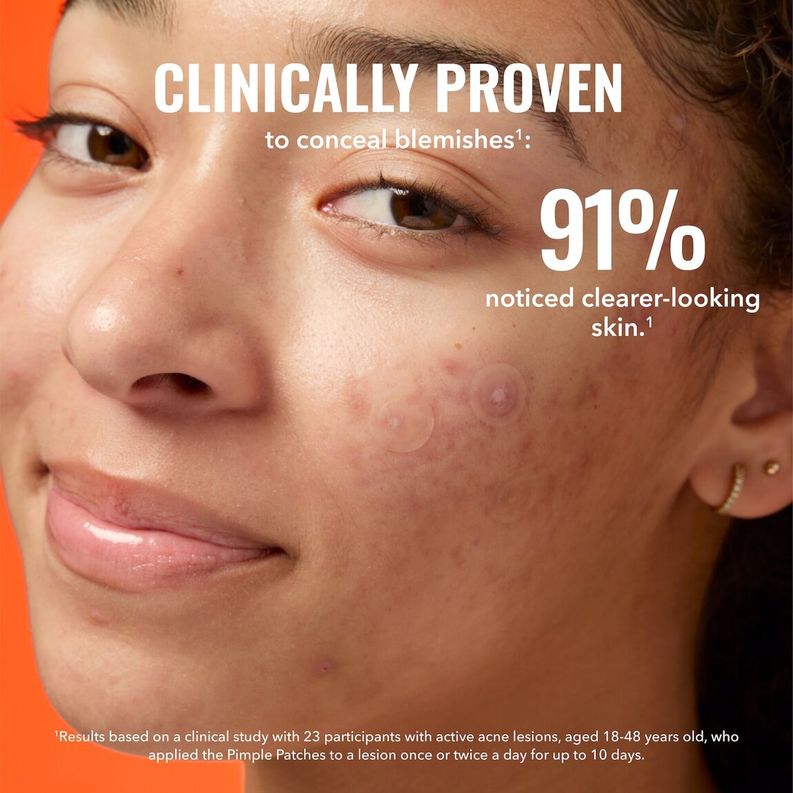 pimple-patches-p4 zb_p.jpg