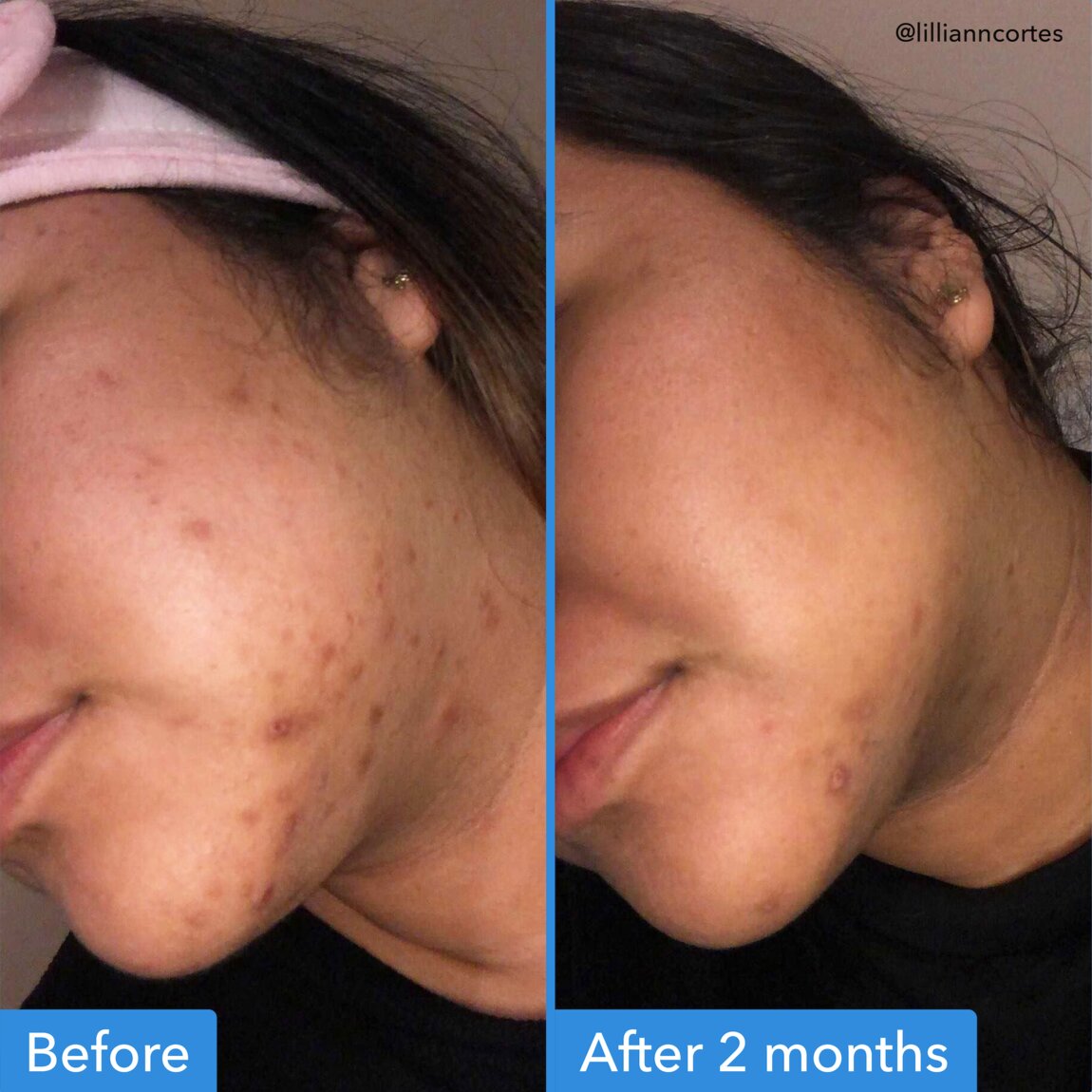 discoloration-correcting-serum-k4 zb_p.jpg